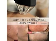 リメレ(Rimere)の雰囲気（エステ版ダ★マペン！真皮層からアプローチ！）