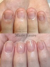 マリーロール 天王寺店(Marie Laure)/自爪育成/深爪矯正/ネイルケア