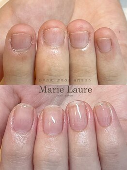 マリーロール 天王寺店(Marie Laure)/自爪育成/深爪矯正/ネイルケア
