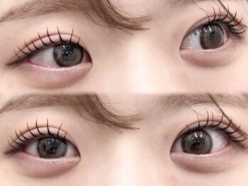 リートゥ(Riitoo)/アンドヘルシー/ブラック120本