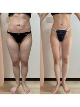 パピヨン(Papillon)/ムチムチ下半身大変身◎