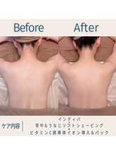 スー(Sue)/ブライダルや撮影対策に