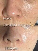 リイル バイ クレビア(REILE by Crebia)/お客様写真