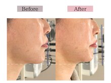 フロリール アザブジュウバン(FlorirAzabujuban)/3D小顔/造顔フェイシャル