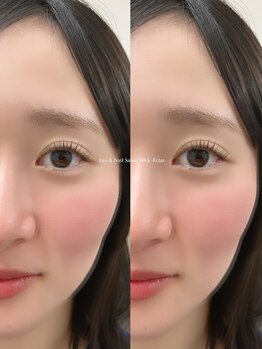 エムエスエー エクラ(MSA Eclat)/まつ毛パーマ