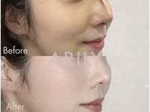 アリリィ(ARILY)/ARILY after care salon