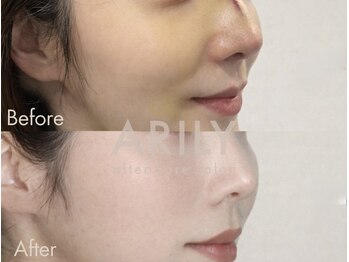 アリリィ(ARILY)/ARILY after care salon