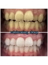 ホワイトニングショップ 南堀江店/セルフホワイトニング[心斎橋]