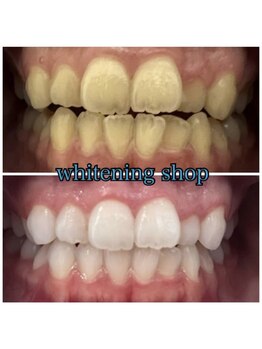 ホワイトニングショップ 南堀江店/セルフホワイトニング[心斎橋]