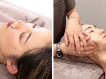 ミプラス鍼灸スタジオの写真/《結果重視・皮膚科専門医監修サロン》お客様満足度◎当店独自の手技でリピート間違いなしの高い技術♪