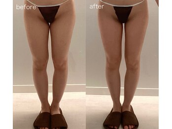 レイジュ(reiju)/【サーモシェイプ　下半身 3回】