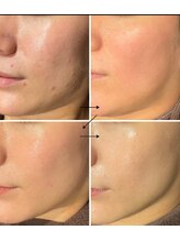 スリリアン 銀座/★お客さまビフォーアフター★