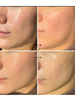 スリリアン 銀座/★お客さまビフォーアフター★