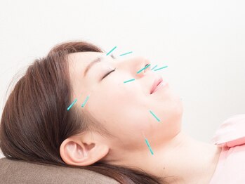 琴似あおば鍼灸整骨院の写真/プロが悩みの原因を究明！≪部分鍼+美容鍼¥7,700≫眠れない、疲れがとれない方へ★全身鍼灸¥6,600も人気◎