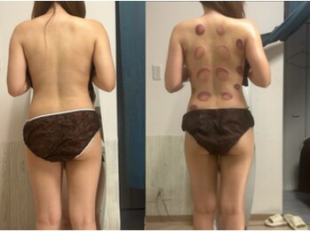 オーシャンブルーム 目黒(OceanBloom)/上半身