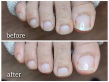 爪切り屋 足楽/足の臭いのモト…