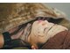エピリス(Epiliss)の写真/【四日市ハーブピーリングでニキビ改善】ご新規様限定♪ツルツルの圧倒的な美肌へ◎¥20,000→¥8,800