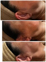 Ms.やまとなでしこ/ビフォーアフター写真