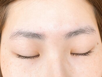 シェリー(Cherie)/before