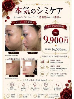 ニコ 岐南本店(Nico)の写真/結果重視Nico【本気のシミケア】シミだけじゃなく
くすみ、たるみ、毛穴、赤ら顔改善にも○
