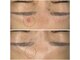 オーリス(Aurise)の写真