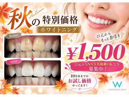 ホワイトニングショップ 富山店の写真