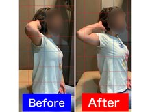 ナオル整体 仙台院(NAORU整体)/40代女性　「巻き肩の悩み」