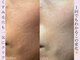 リプラス(Replus)の写真
