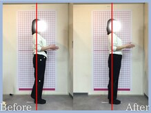 トロ整骨院(toro整骨院)/骨格矯正★1回の効果★30代女性