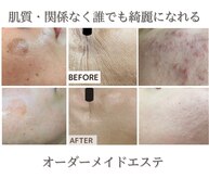 ミーラブ 鹿児島(miilove)