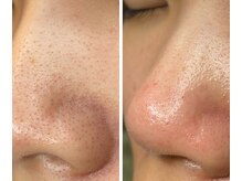 サイ(Sai)/before⇒after