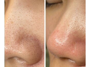 サイ(Sai)/before⇒after