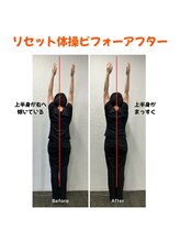 カイロプラクティック カーブ/体の傾きが整うと若見え！？