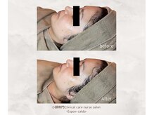 エスポワールカルド(Espoir caldo)/