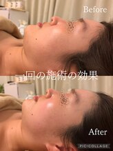 ラムール(L'amour)/最強の結果出しは当店で♪