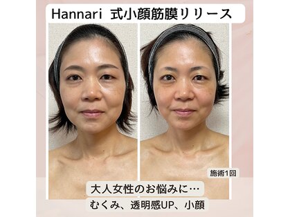 ハンナリ(Hannari)の写真