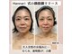ハンナリ(Hannari)の写真