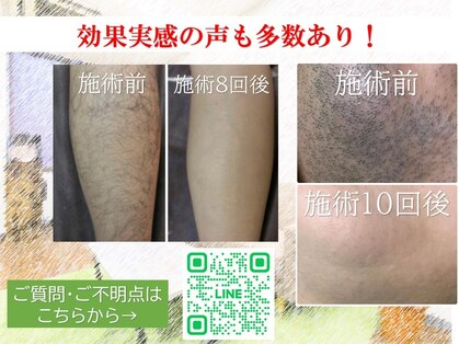 メモリー(memory)の写真
