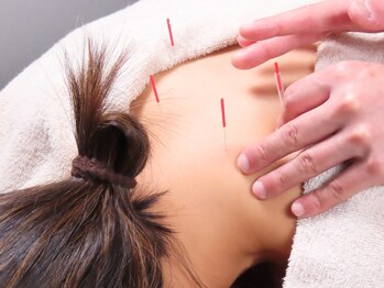 かなざわ鍼灸院/