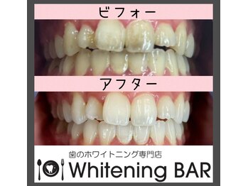 ホワイトニングバー 横浜ビブレ店
