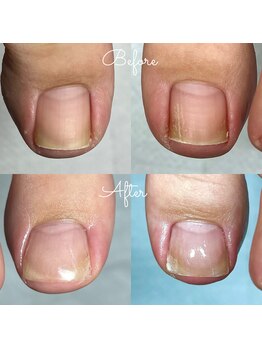 見た目が綺麗な補正が好評です