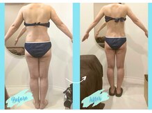 千歳の女神 西尾本店/【施術風景】Before/After