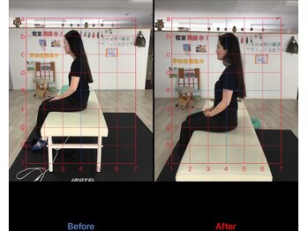 ストレチックス 近江八幡店/BeforeAfter