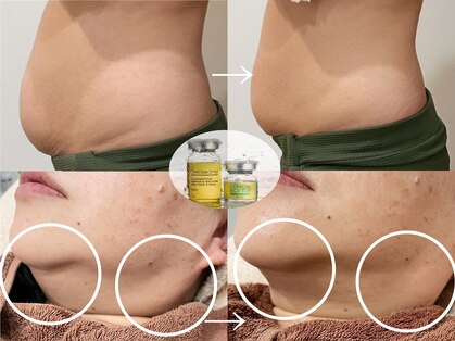 エミュ(emu)の写真