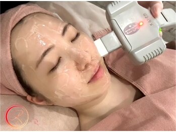 アールリンク(R-Link)の写真/【人気NO,1メニュー】お顔脱毛(眉間,鼻,もみあげ含)はお肌に優しい注目の最新脱毛がお勧め！敏感肌の方もOK