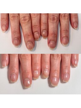 ルクレール カシェット(Le clair cachette)/美爪育成コース