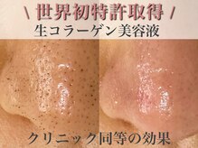 エミナル(eminal)