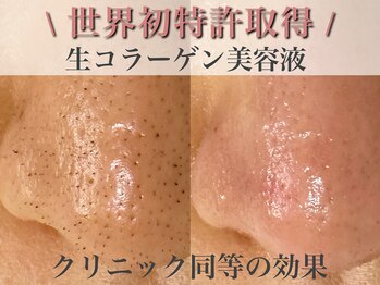 エミナル(eminal)