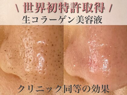 エミナル(eminal)の写真