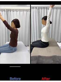整体リアン 天神院(Lien)/ビフォーアフター:肩の可動域